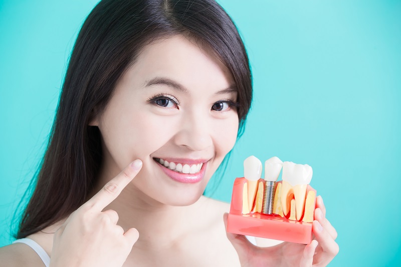 woman pointing to her smile while holding examples of dental implants