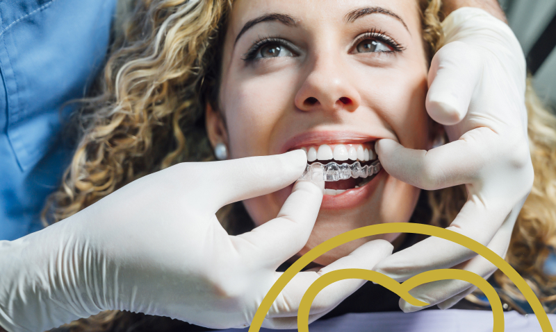 Even with Invisalign you need to take care of your teeth