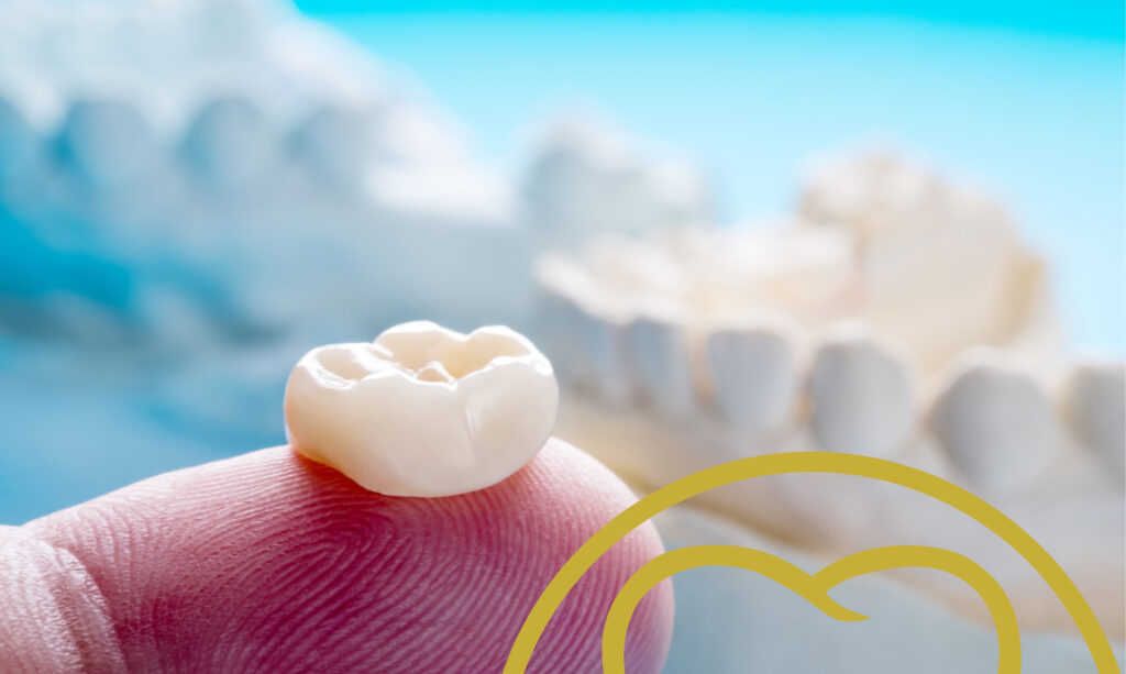 Dental crowns or fillings?
