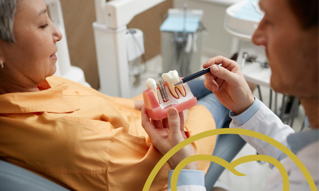 Dental implants for missing teeth.