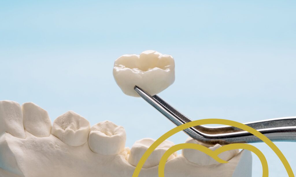 Gold or zirconia dental crowns?