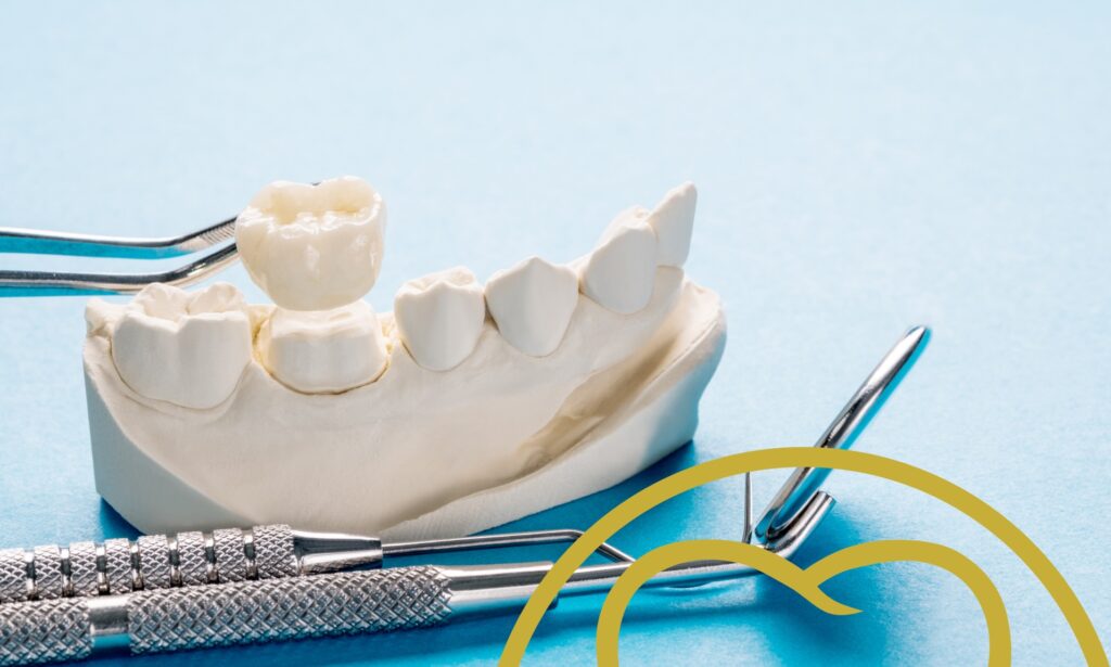 Is it time for a new dental crown?