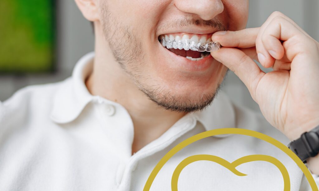 Retainers matter in orthodontic treatment.